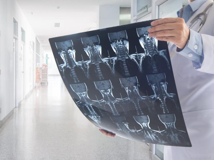 Lekarz oglądający tomografię kręgosłupa szyjnego