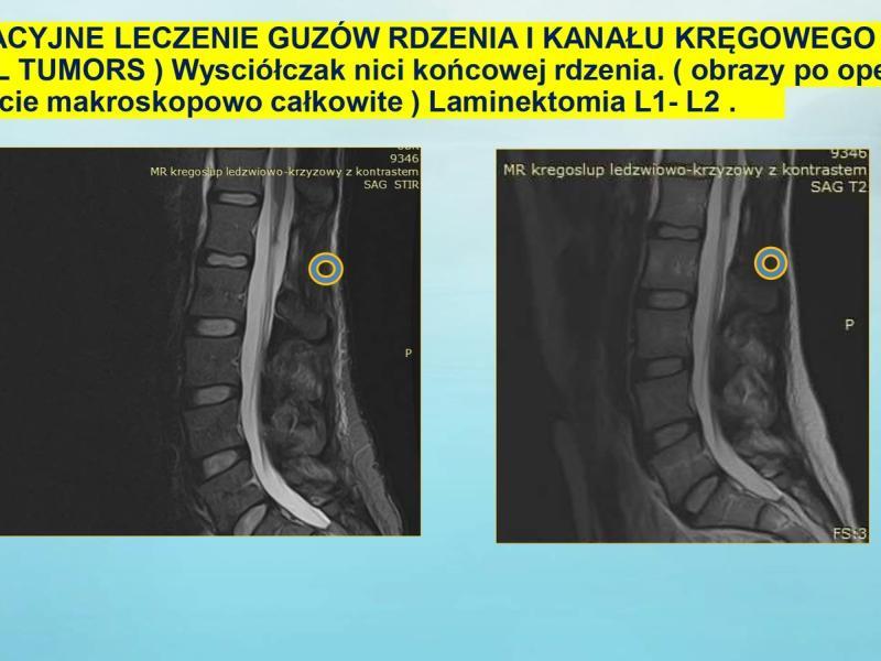 prezentacja-10