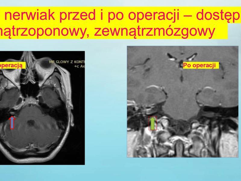 prezentacja-17